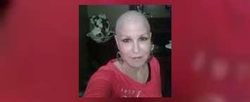 Annette Roy changed her profile picture on Facebook to her without hair six years ago for Breast Cancer Awareness Month. October 11, 2018. (Photo courtesy of Annette Roy's Facebook page)